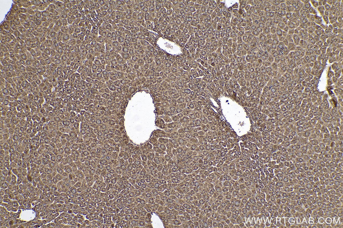 Immunohistochemical analysis of paraffin-embedded mouse liver tissue slide using KHC0588 (VDAC1/2 IHC Kit).