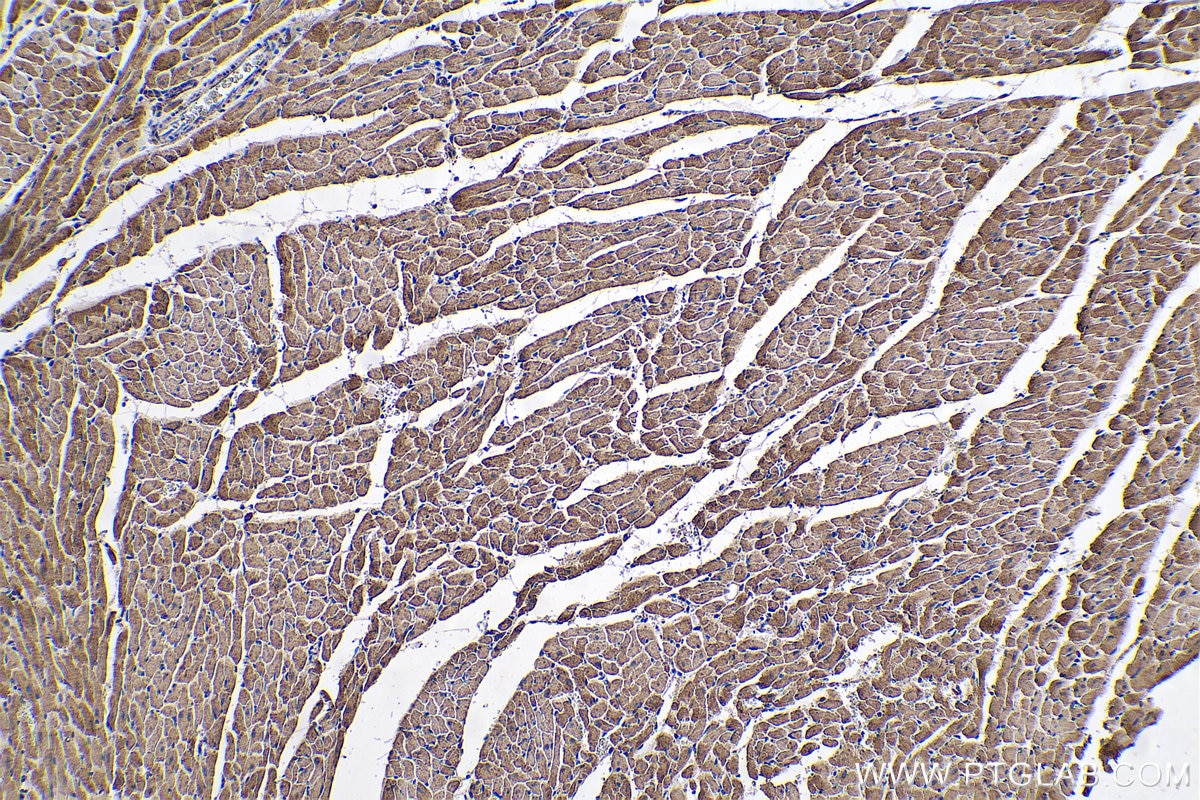 Immunohistochemical analysis of paraffin-embedded rat heart tissue slide using KHC0588 (VDAC1/2 IHC Kit).