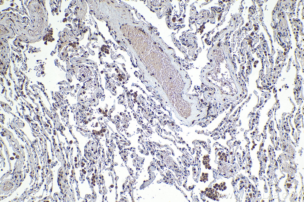 Immunohistochemical analysis of paraffin-embedded human lung tissue slide using KHC1323 (VEGFC IHC Kit).