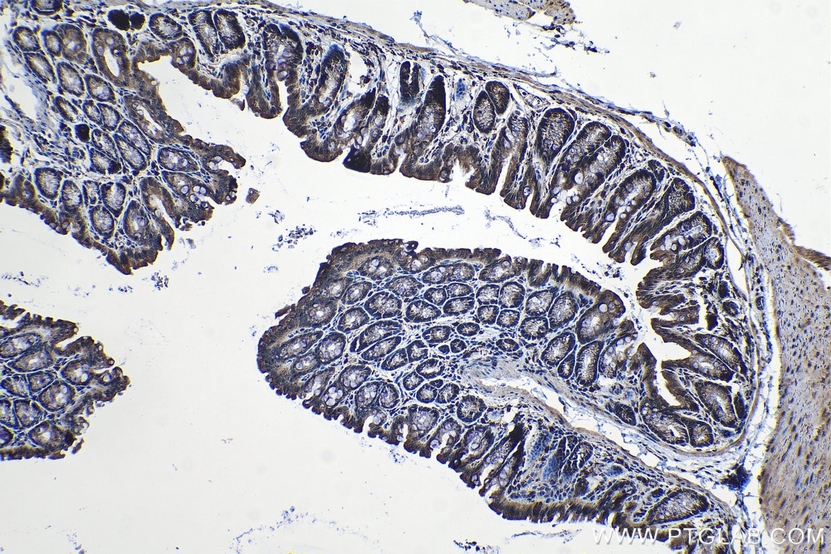 Immunohistochemical analysis of paraffin-embedded mouse colon tissue slide using KHC1323 (VEGFC IHC Kit).