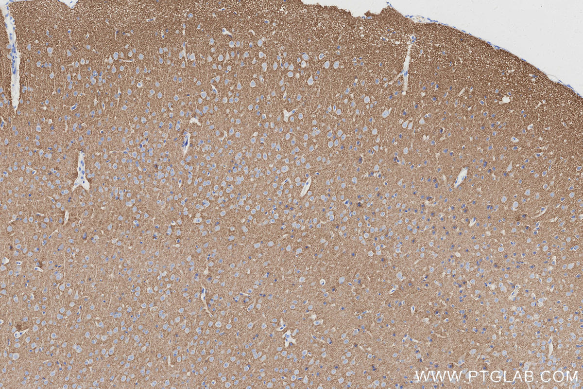 Immunohistochemical analysis of paraffin-embedded mouse brain tissue slide using KHC2996 (VGLUT1 IHC Kit).