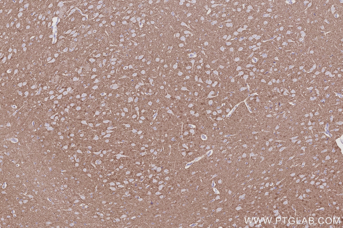 Immunohistochemical analysis of paraffin-embedded rat brain tissue slide using KHC2996 (VGLUT1 IHC Kit).