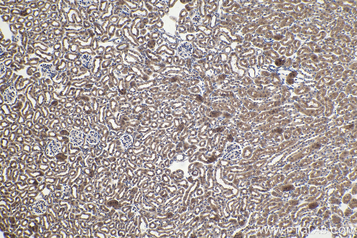 Immunohistochemical analysis of paraffin-embedded mouse kidney tissue slide using KHC1592 (VHL IHC Kit).