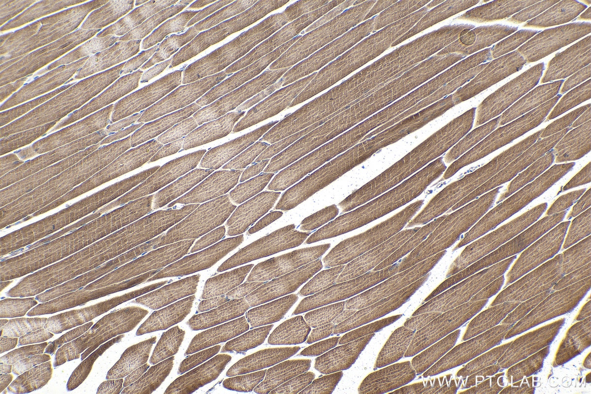 Immunohistochemical analysis of paraffin-embedded mouse skeletal muscle tissue slide using KHC1592 (VHL IHC Kit).