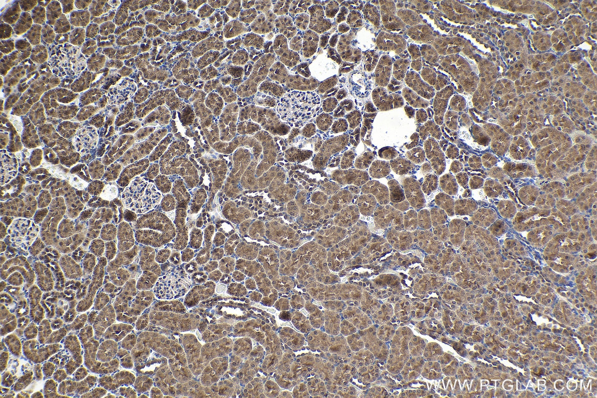 Immunohistochemical analysis of paraffin-embedded rat kidney tissue slide using KHC1592 (VHL IHC Kit).