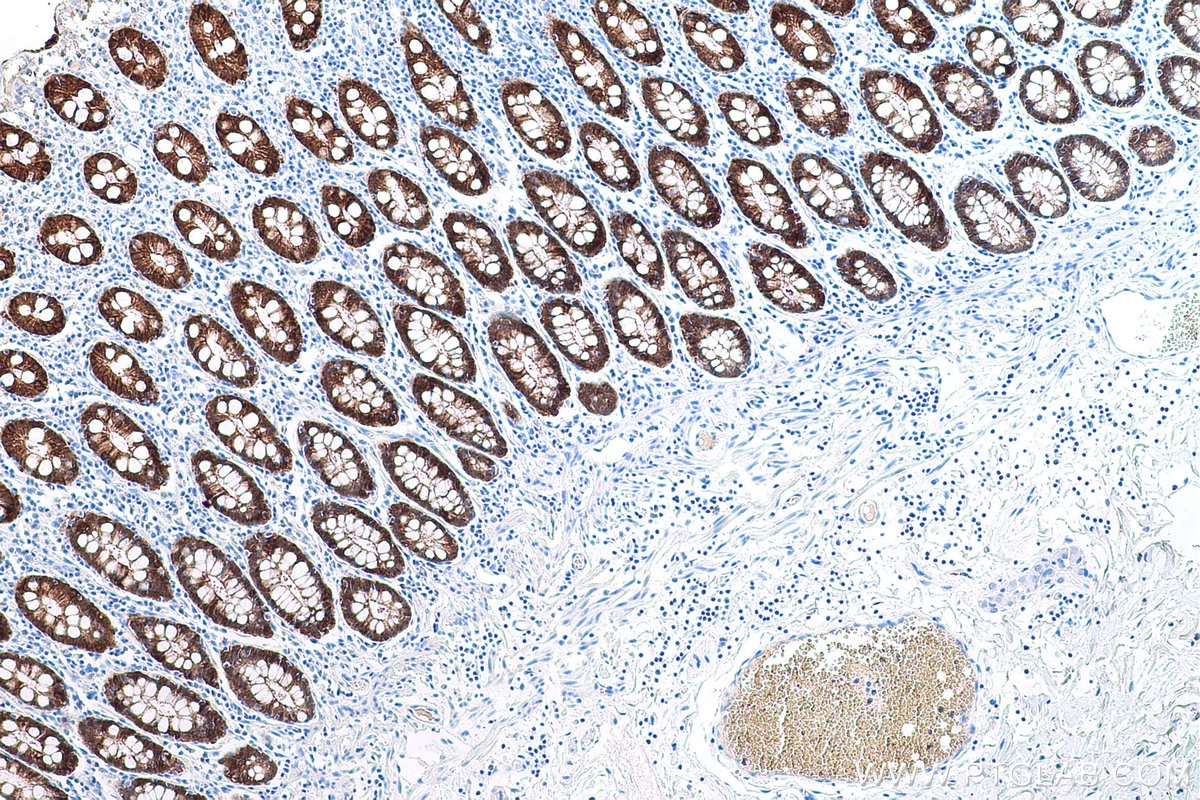 Immunohistochemical analysis of paraffin-embedded human colon tissue slide using KHC0601 (VIL1 IHC Kit).