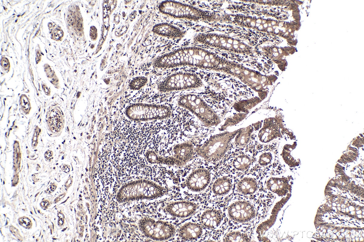 Immunohistochemical analysis of paraffin-embedded human colon tissue slide using KHC0149 (VIRMA/KIAA1429 IHC Kit).