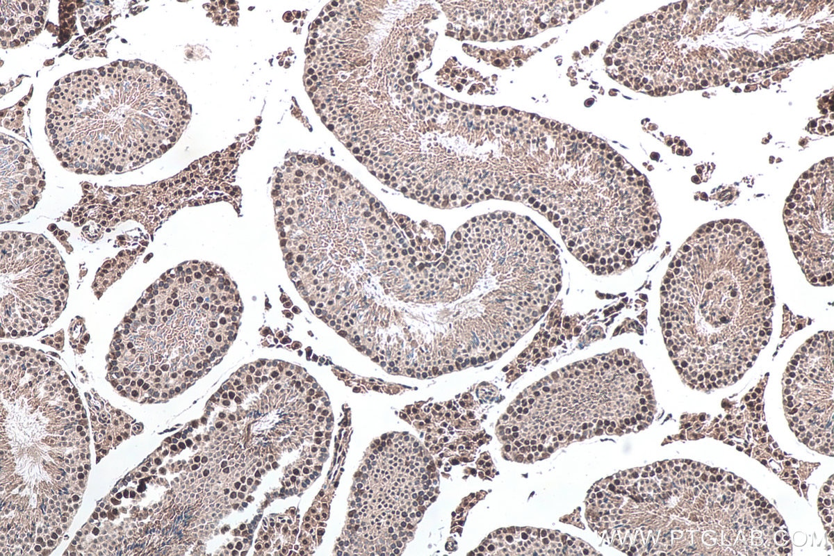 Immunohistochemical analysis of paraffin-embedded mouse testis tissue slide using KHC0149 (VIRMA/KIAA1429 IHC Kit).