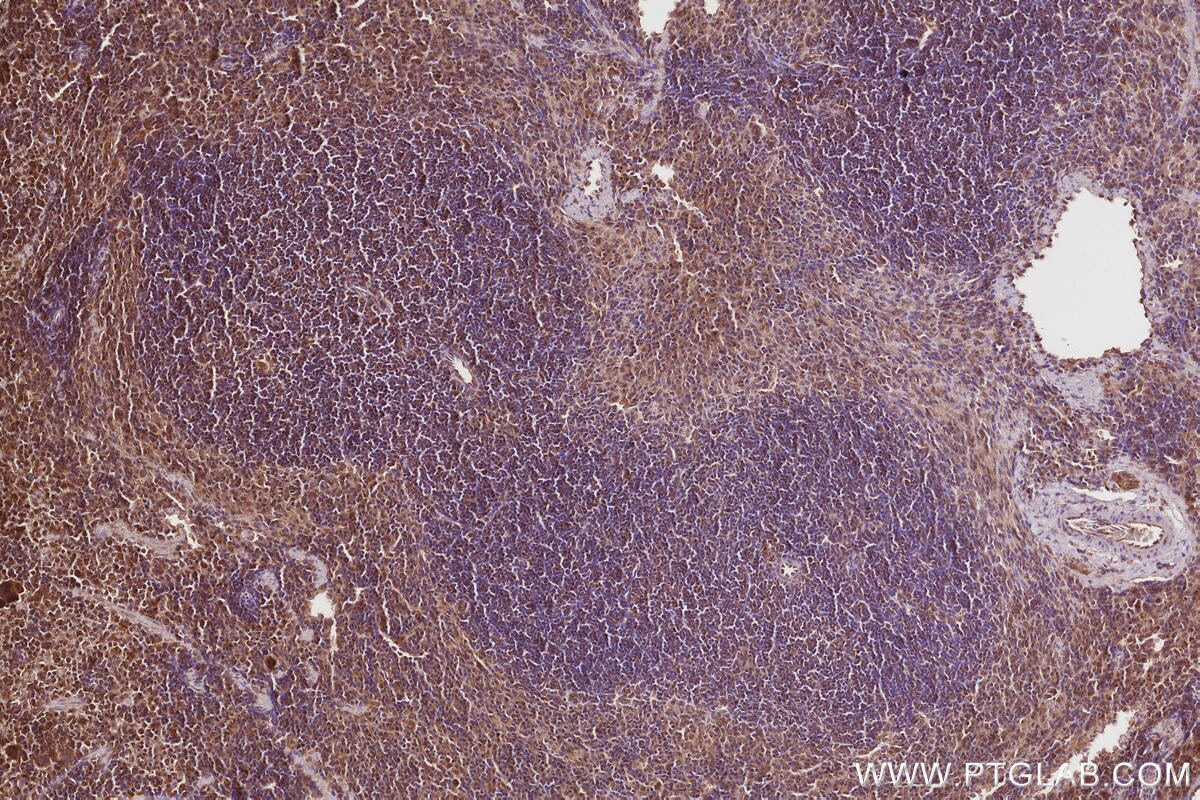 Immunohistochemical analysis of paraffin-embedded mouse spleen tissue slide using KHC2843 (VPS15 IHC Kit).
