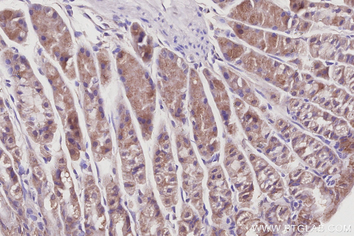 Immunohistochemical analysis of paraffin-embedded mouse stomach tissue slide using KHC3062 (VPS24 IHC Kit). Immunohistochemical analysis of paraffin-embedded mouse stomach tissue slide using KHC3062 (VPS24 IHC Kit).