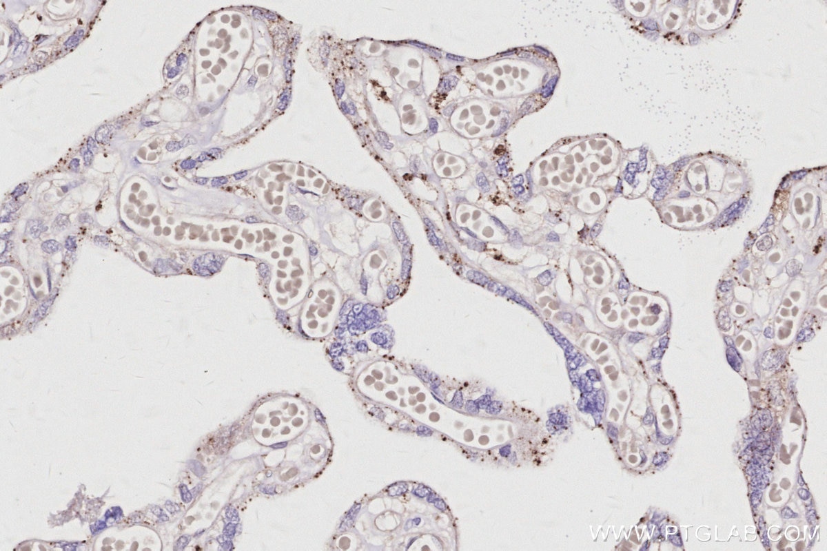 Immunohistochemical analysis of paraffin-embedded human placenta tissue slide using KHC3062 (VPS24 IHC Kit). Immunohistochemical analysis of paraffin-embedded human placenta tissue slide using KHC3062 (VPS24 IHC Kit).