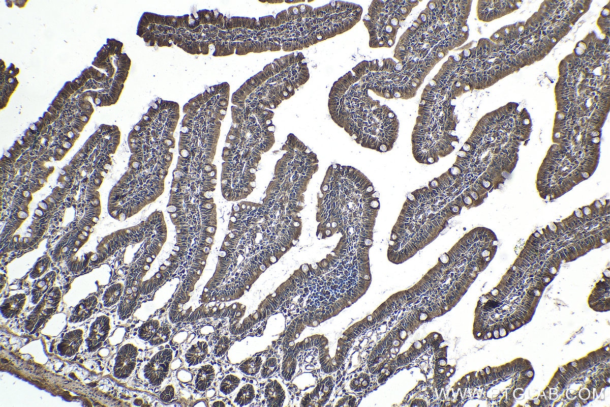 Immunohistochemical analysis of paraffin-embedded rat small intestine tissue slide using KHC1900 (VPS25 IHC Kit).
