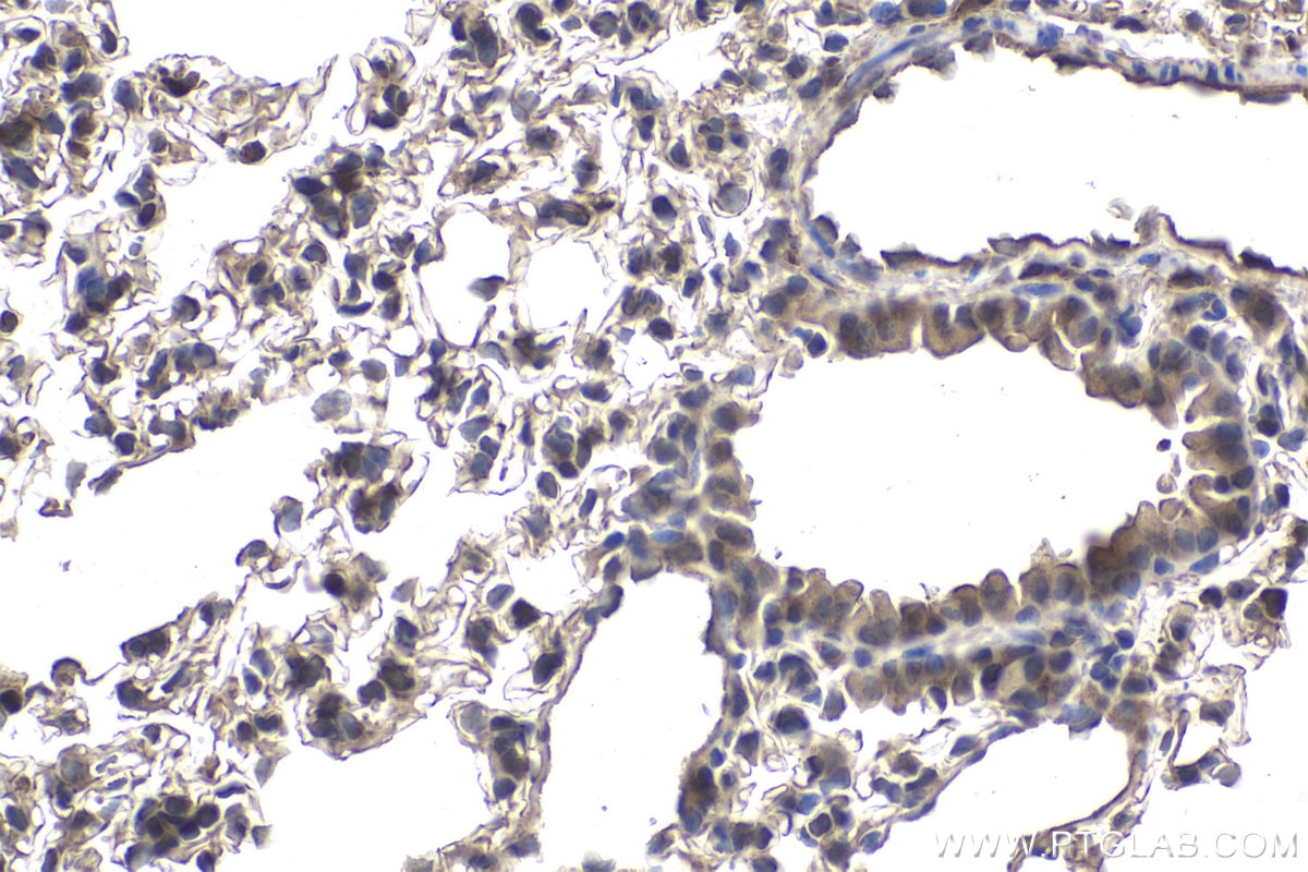 Immunohistochemical analysis of paraffin-embedded mouse lung tissue slide using KHC1900 (VPS25 IHC Kit).