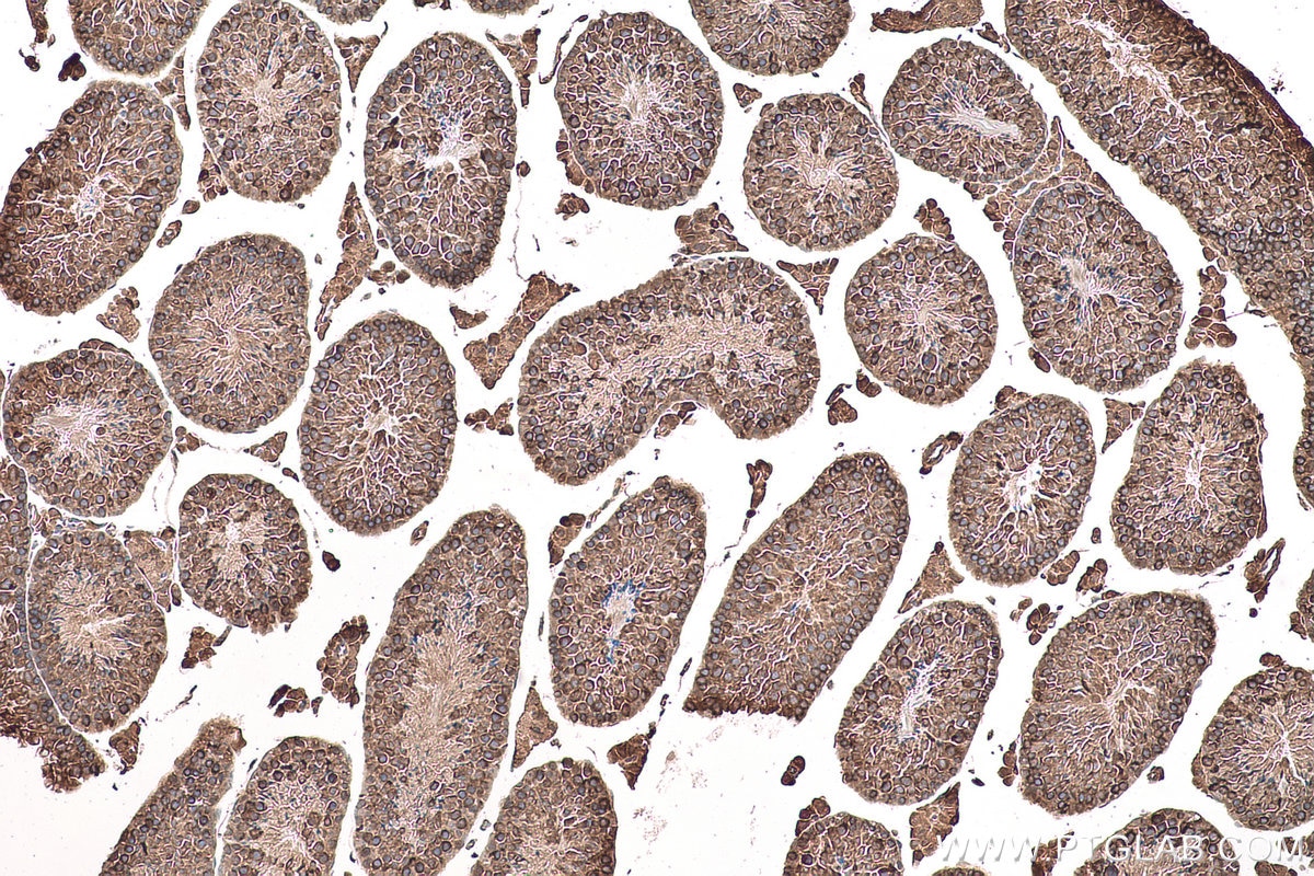 Immunohistochemical analysis of paraffin-embedded mouse testis tissue slide using KHC0961 (VPS26A IHC Kit).