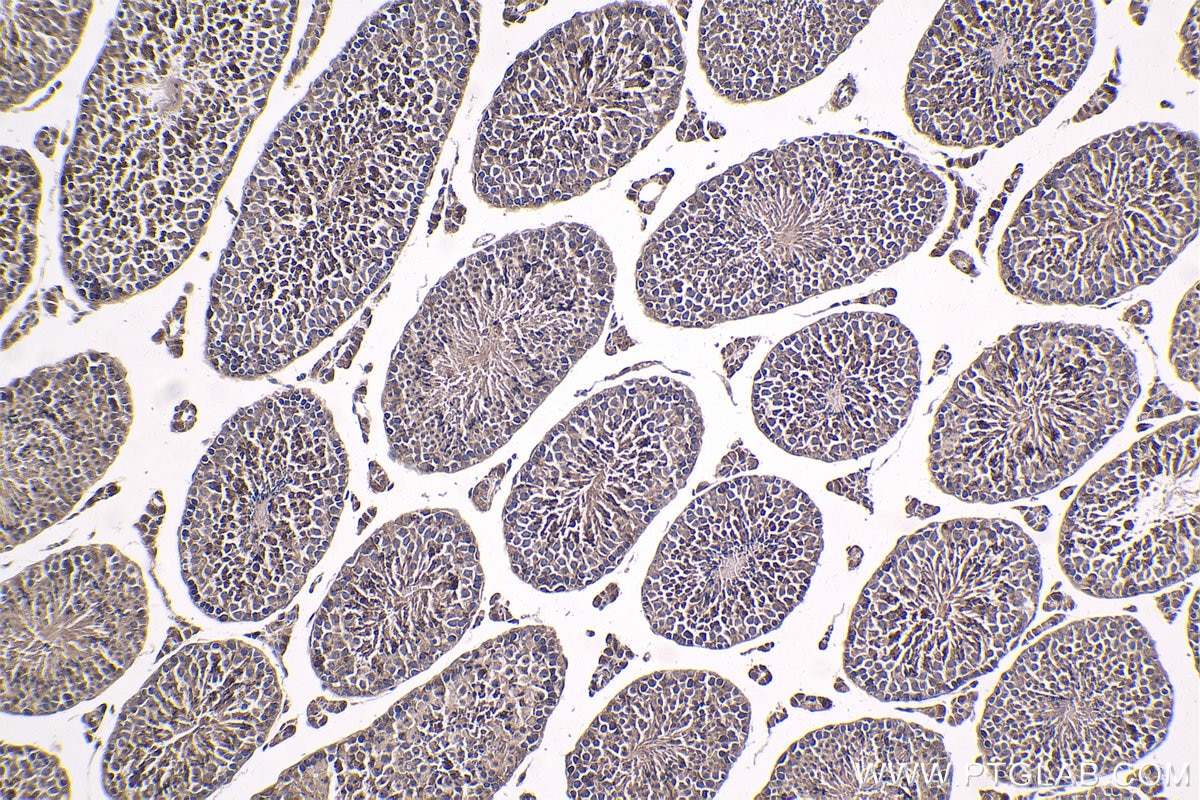 Immunohistochemical analysis of paraffin-embedded mouse testis tissue slide using KHC1809 (VPS36 IHC Kit).