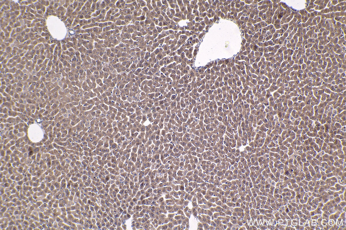 Immunohistochemical analysis of paraffin-embedded mouse liver tissue slide using KHC1809 (VPS36 IHC Kit).