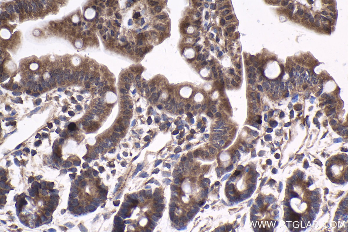 Immunohistochemical analysis of paraffin-embedded mouse small intestine tissue slide using KHC1809 (VPS36 IHC Kit).