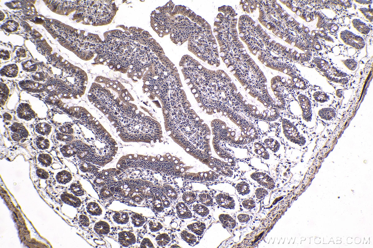 Immunohistochemical analysis of paraffin-embedded rat small intestine tissue slide using KHC1809 (VPS36 IHC Kit).
