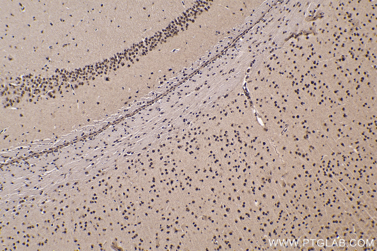 Immunohistochemical analysis of paraffin-embedded mouse brain tissue slide using KHC1756 (VPS72 IHC Kit).