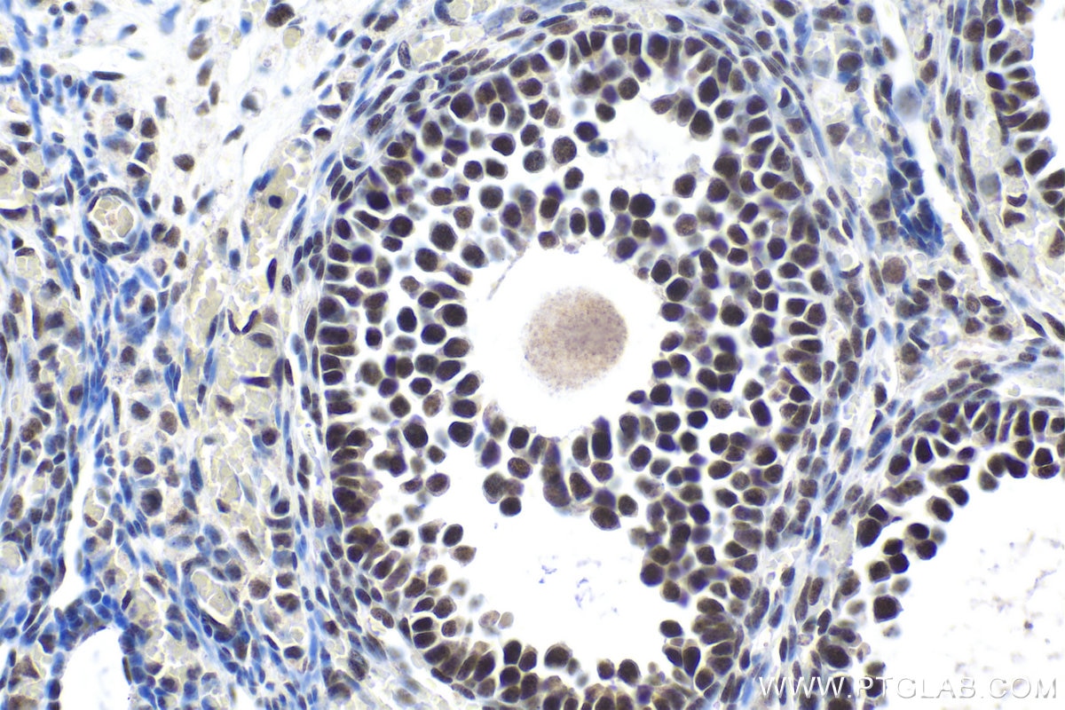 Immunohistochemical analysis of paraffin-embedded mouse ovary tissue slide using KHC1756 (VPS72 IHC Kit).