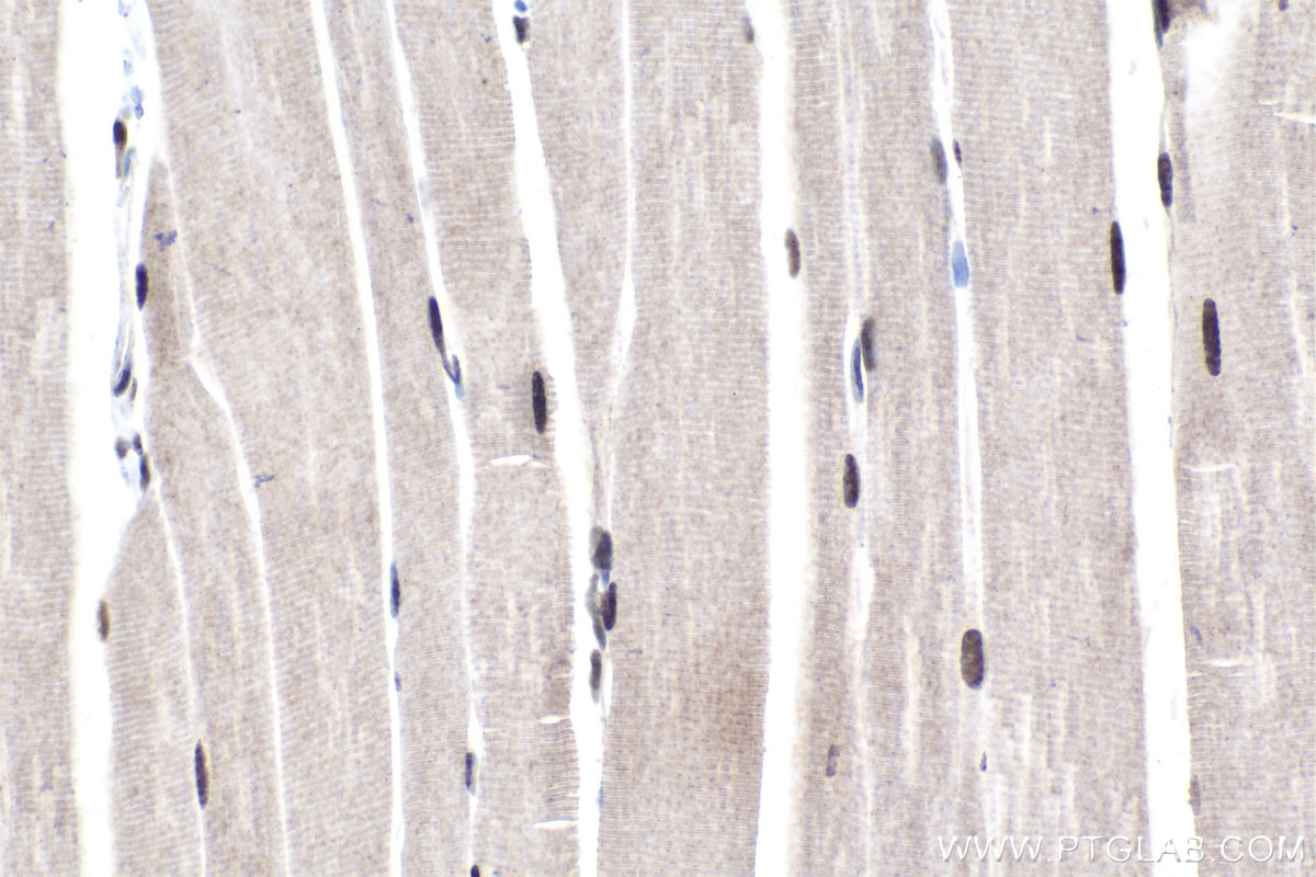 Immunohistochemical analysis of paraffin-embedded mouse skeletal muscle tissue slide using KHC1756 (VPS72 IHC Kit).
