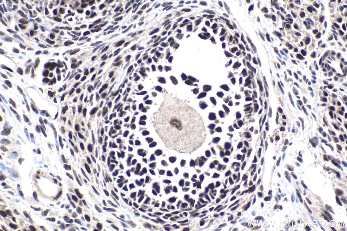 Immunohistochemical analysis of paraffin-embedded rat ovary tissue slide using KHC1756 (VPS72 IHC Kit).