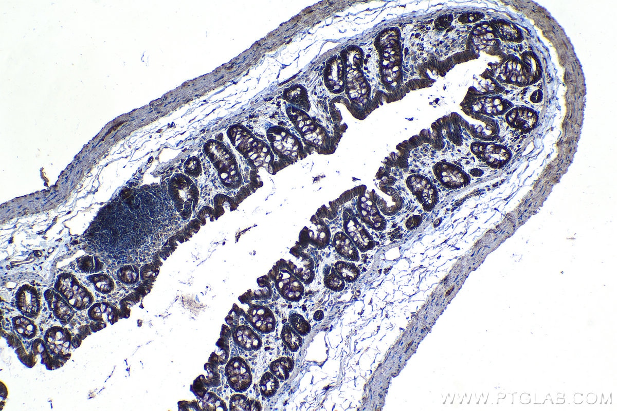 Immunohistochemical analysis of paraffin-embedded rat colon tissue slide using KHC1224 (VTCN1 IHC Kit).