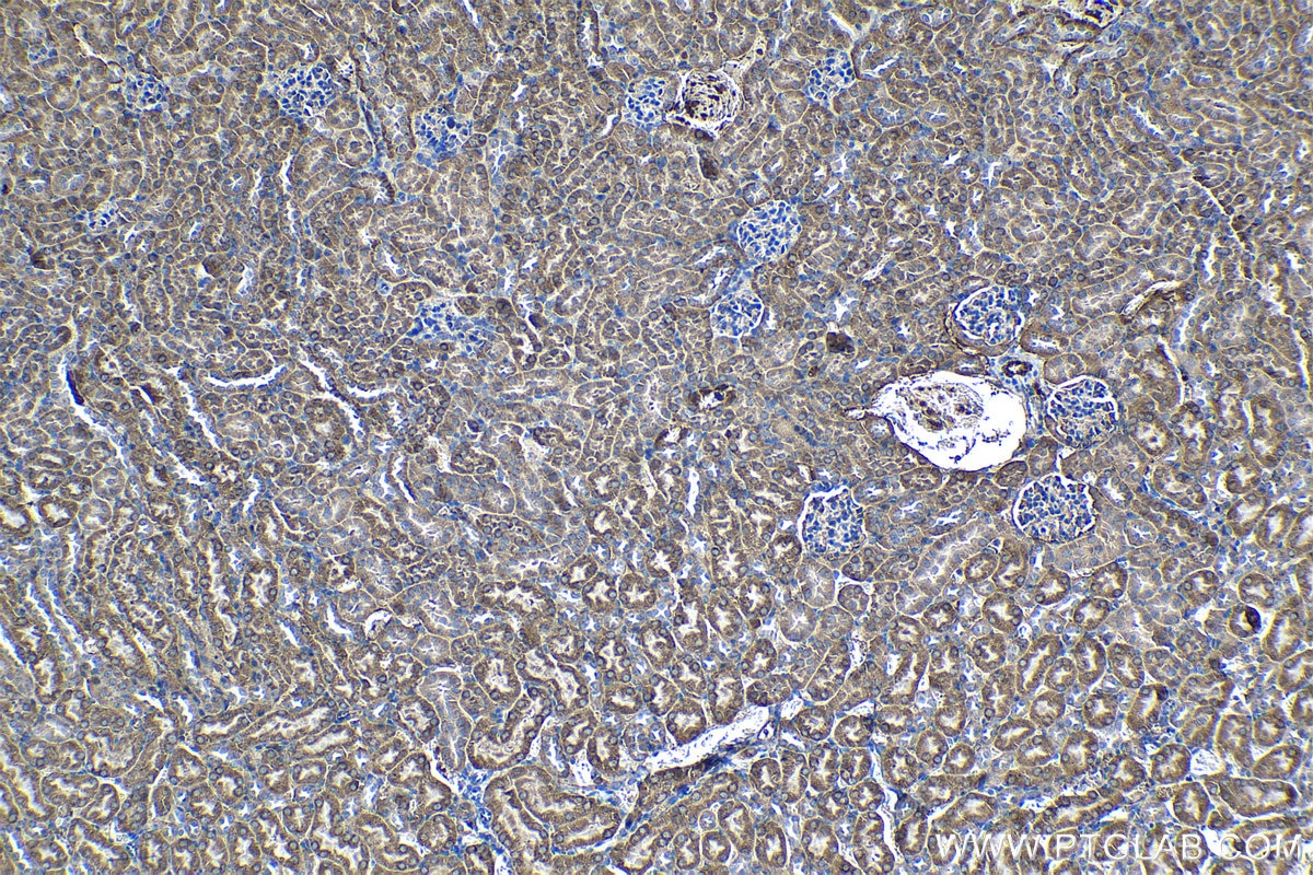 Immunohistochemical analysis of paraffin-embedded mouse kidney tissue slide using KHC1224 (VTCN1 IHC Kit).