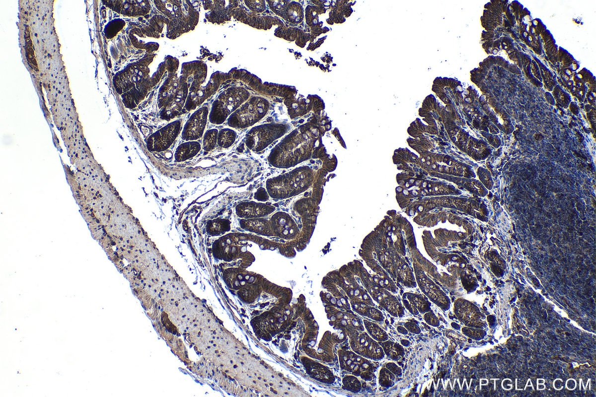 Immunohistochemical analysis of paraffin-embedded mouse colon tissue slide using KHC1224 (VTCN1 IHC Kit).