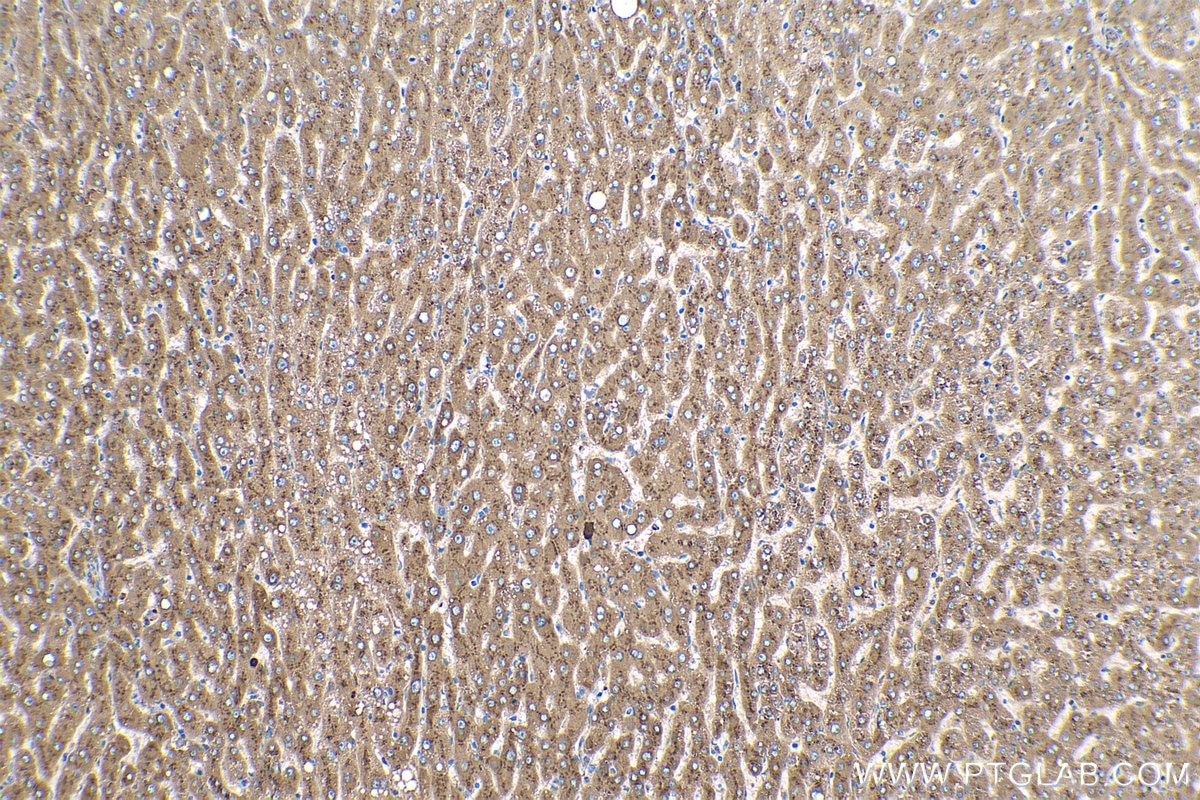 Immunohistochemical analysis of paraffin-embedded human liver tissue slide using KHC0122 (VTN IHC Kit).