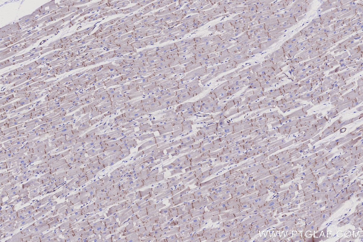 Immunohistochemical analysis of paraffin-embedded human heart tissue slide using KHC3081 (Vinculin IHC Kit). Immunohistochemical analysis of paraffin-embedded human heart tissue slide using KHC3081 (Vinculin IHC Kit).