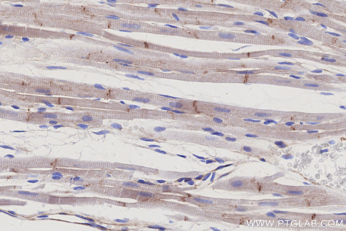 Immunohistochemical analysis of paraffin-embedded rat heart tissue slide using KHC3081 (Vinculin IHC Kit). Immunohistochemical analysis of paraffin-embedded rat heart tissue slide using KHC3081 (Vinculin IHC Kit).