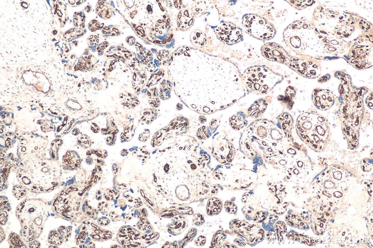 Immunohistochemical analysis of paraffin-embedded human placenta tissue slide using KHC0718 (WARS IHC Kit).