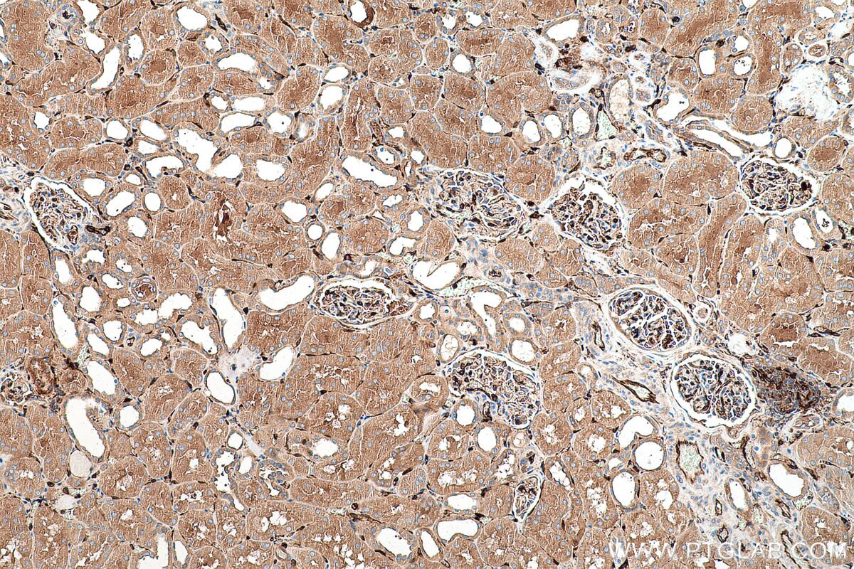 Immunohistochemical analysis of paraffin-embedded human kidney tissue slide using KHC0718 (WARS IHC Kit).