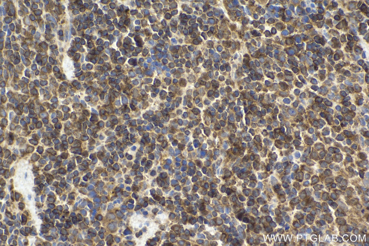 Immunohistochemical analysis of paraffin-embedded mouse spleen tissue slide using KHC1596 (WAS IHC Kit).