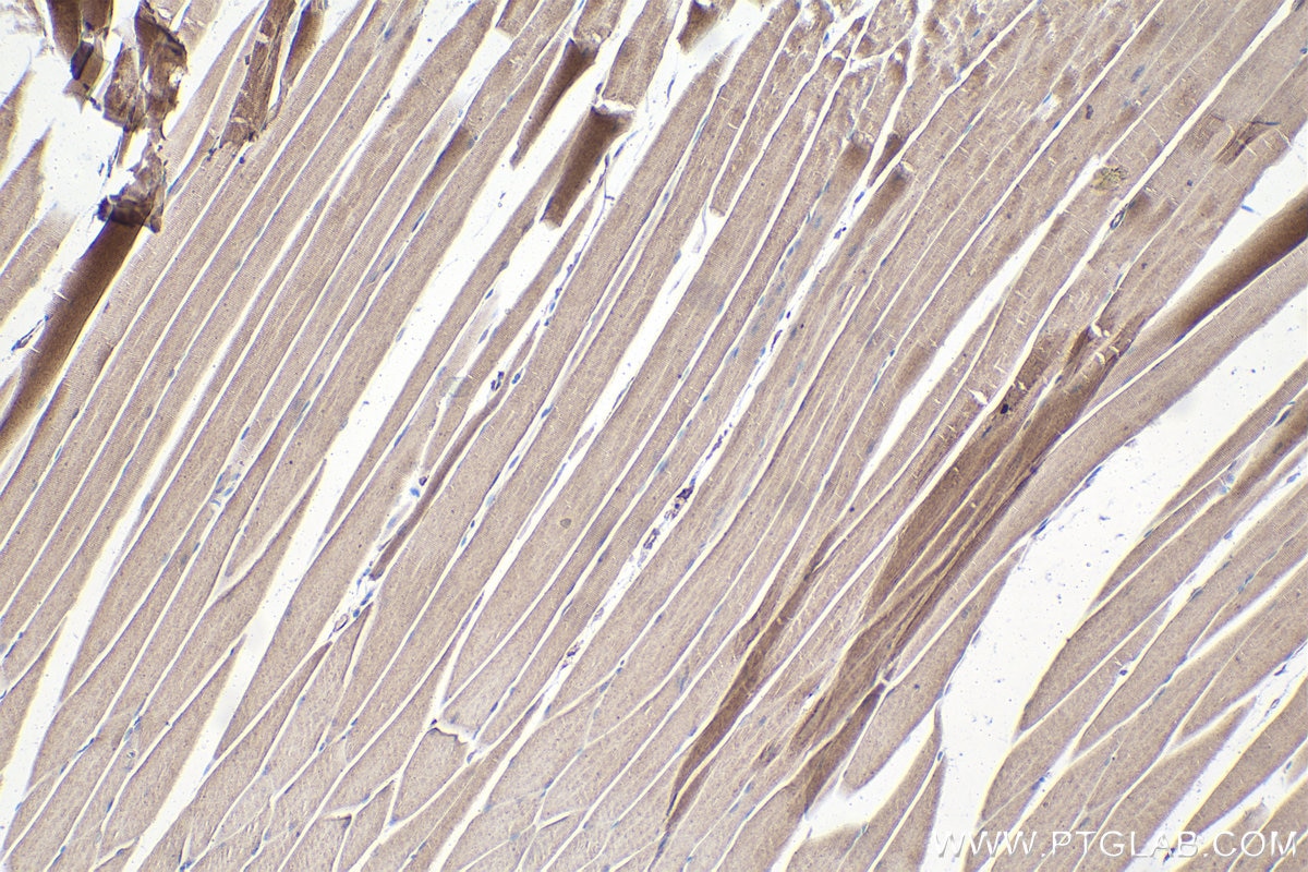 Immunohistochemical analysis of paraffin-embedded mouse skeletal muscle tissue slide using KHC1596 (WAS IHC Kit).