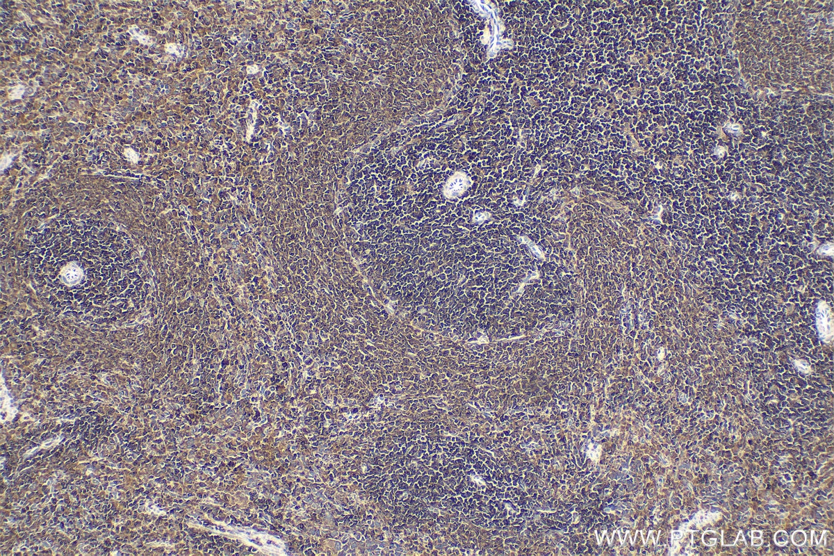 Immunohistochemical analysis of paraffin-embedded rat spleen tissue slide using KHC1596 (WAS IHC Kit).