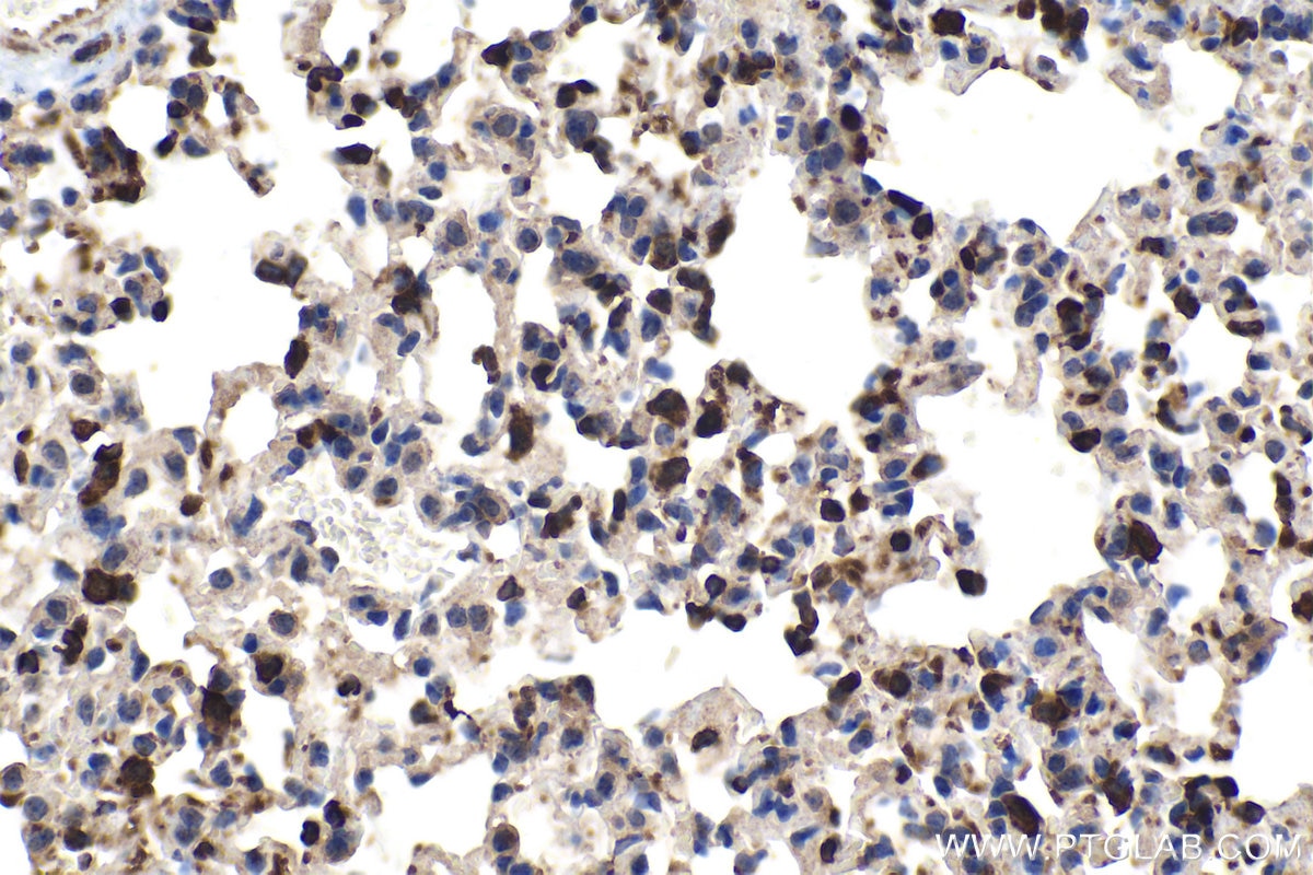 Immunohistochemical analysis of paraffin-embedded mouse lung tissue slide using KHC1596 (WAS IHC Kit).