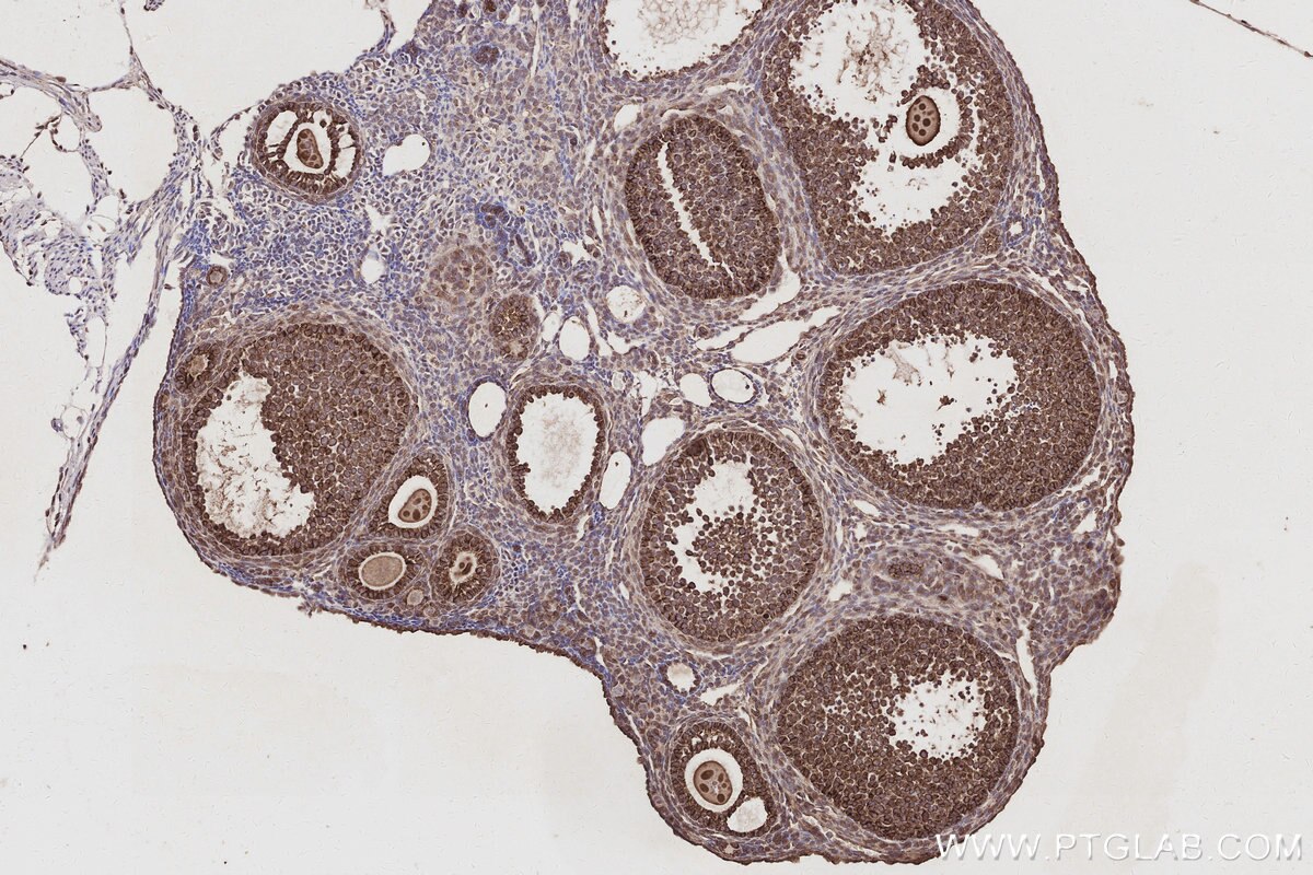 Immunohistochemical analysis of paraffin-embedded mouse ovary tissue slide using KHC3048 (WASF3 IHC Kit).
