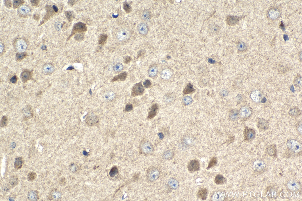 Immunohistochemical analysis of paraffin-embedded mouse brain tissue slide using KHC1422 (WASL IHC Kit).