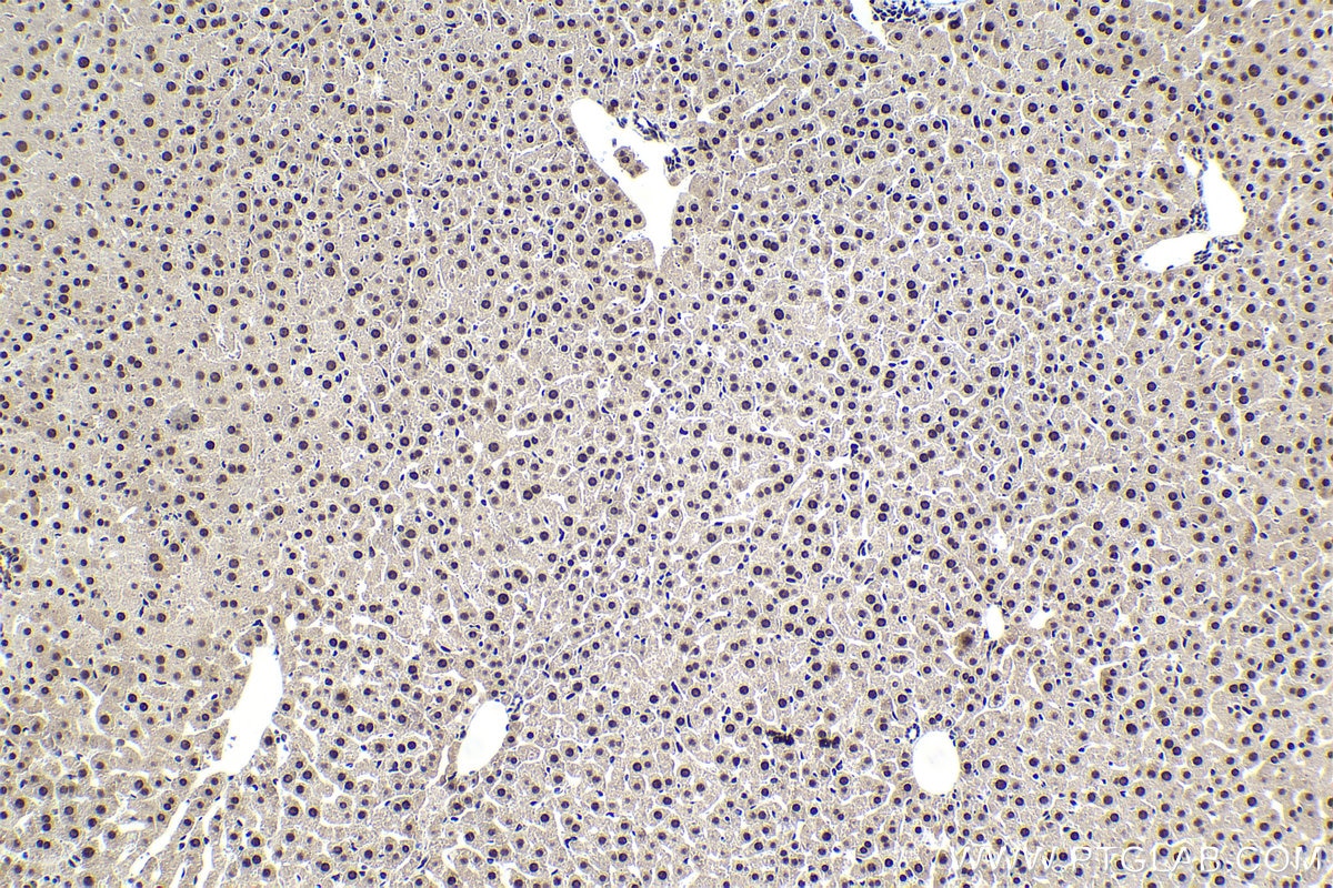Immunohistochemical analysis of paraffin-embedded mouse liver tissue slide using KHC1916 (WDR33 IHC Kit).