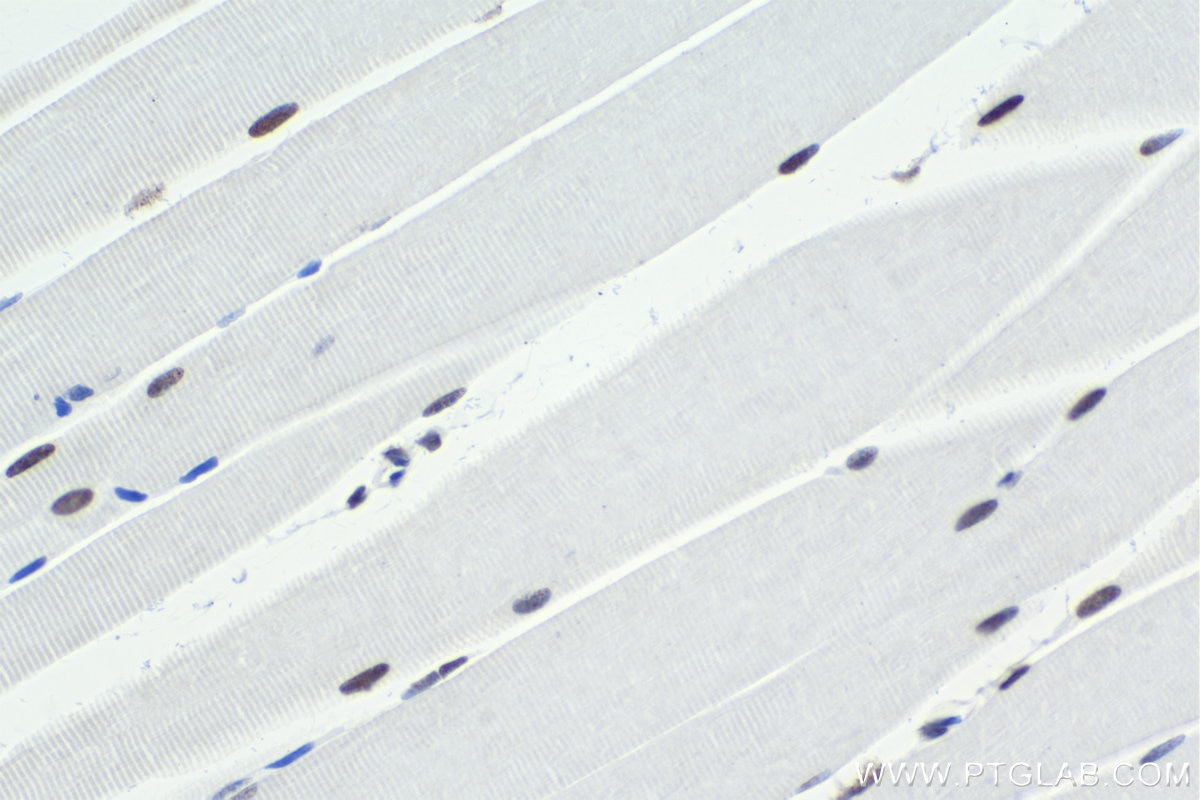 Immunohistochemical analysis of paraffin-embedded mouse skeletal muscle tissue slide using KHC1643 (WDR5 IHC Kit).