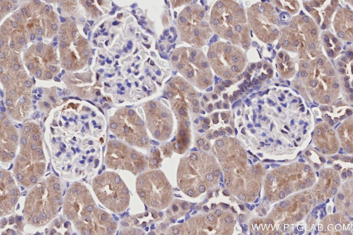Immunohistochemical analysis of paraffin-embedded rat kidney tissue slide using KHC2728 (WIPF2 IHC Kit).