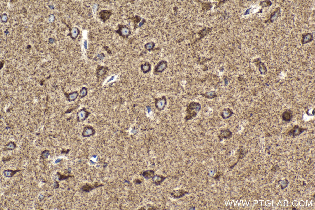 Immunohistochemical analysis of paraffin-embedded mouse brain tissue slide using KHC2051 (WNT10B IHC Kit).