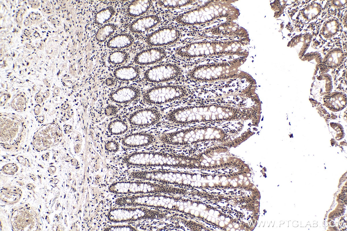 Immunohistochemical analysis of paraffin-embedded human colon tissue slide using KHC0148 (WTAP IHC Kit).