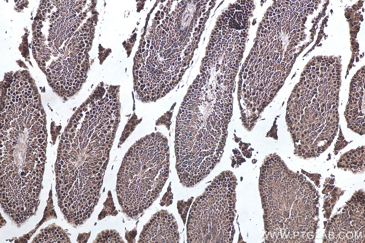 Immunohistochemical analysis of paraffin-embedded mouse testis tissue slide using KHC0148 (WTAP IHC Kit).