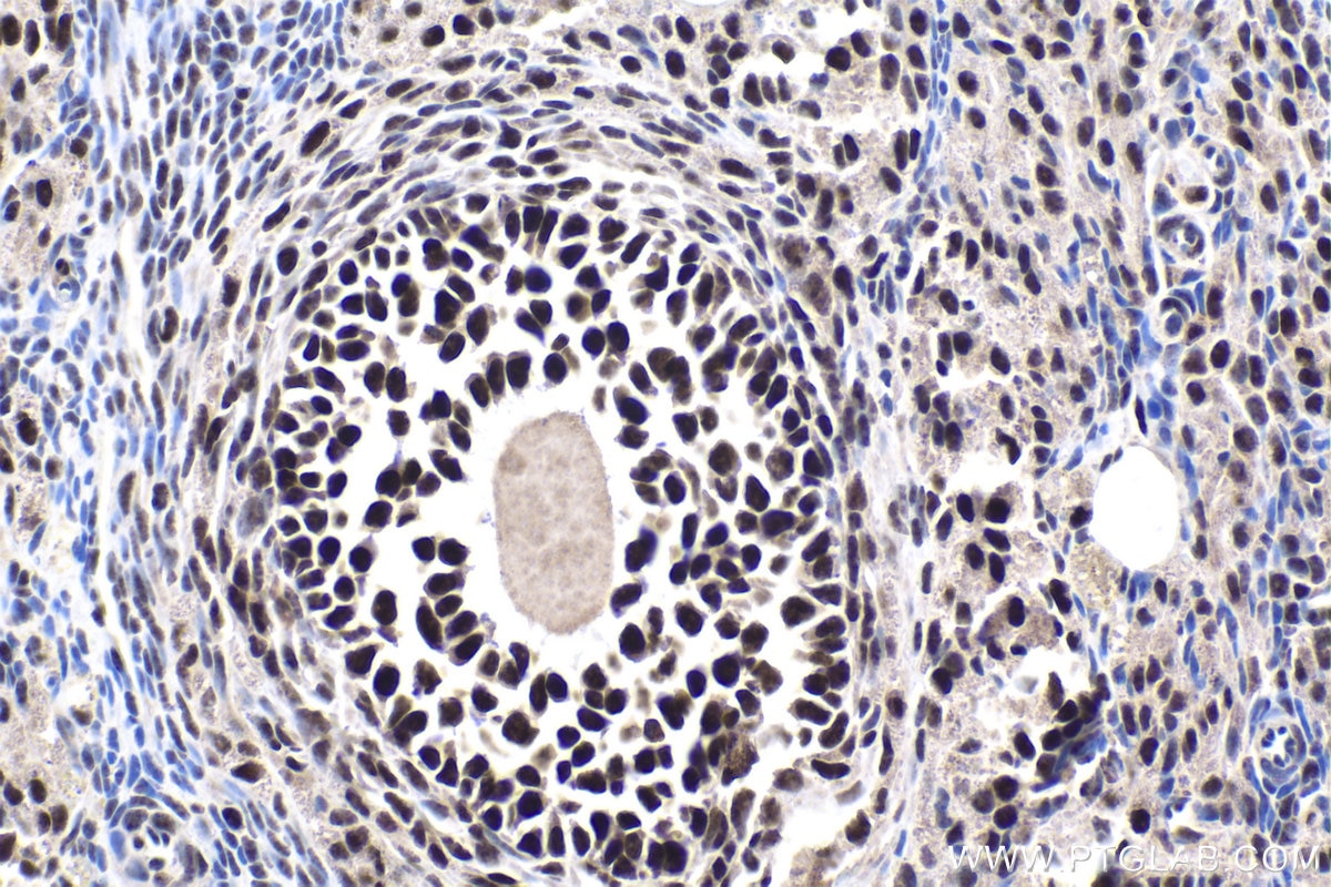 Immunohistochemical analysis of paraffin-embedded rat ovary tissue slide using KHC1947 (XAB2 IHC Kit).