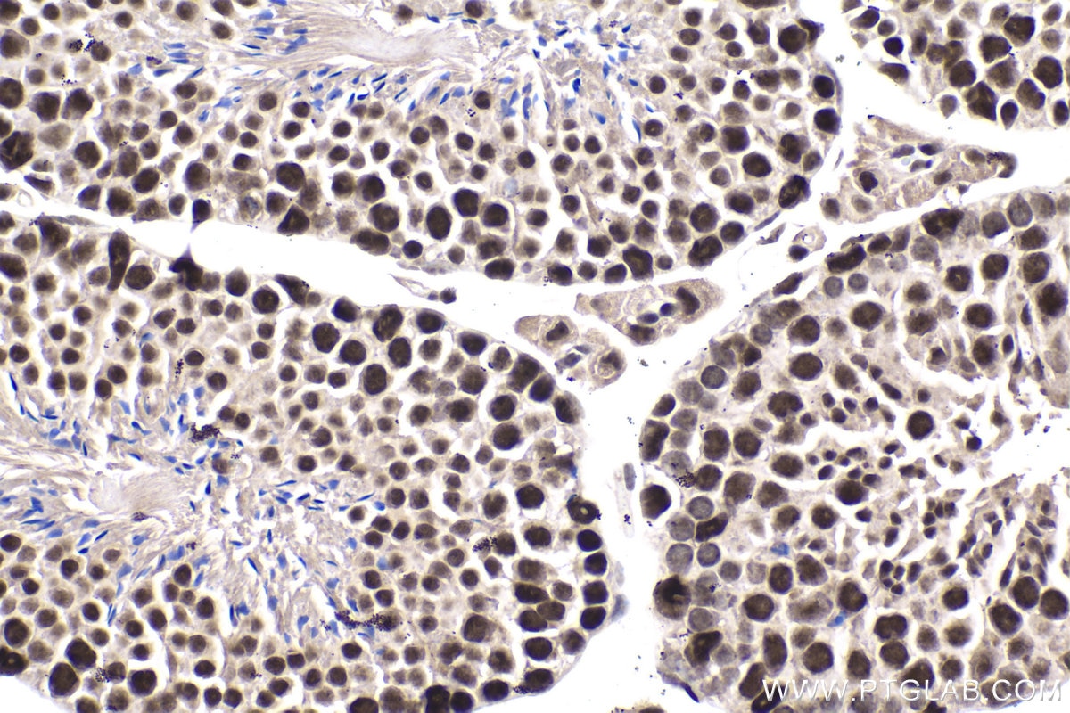Immunohistochemical analysis of paraffin-embedded mouse testis tissue slide using KHC1947 (XAB2 IHC Kit).