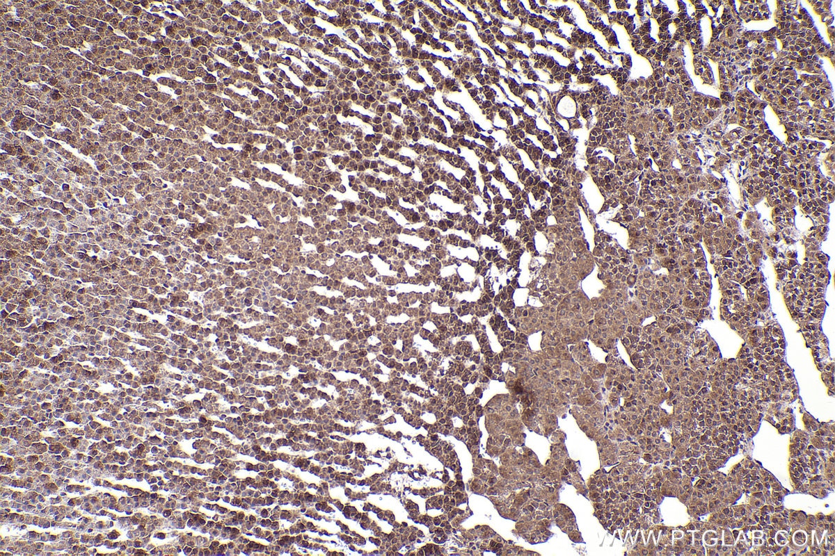Immunohistochemical analysis of paraffin-embedded rat adrenal gland tissue slide using KHC2377 (XIAP IHC Kit).