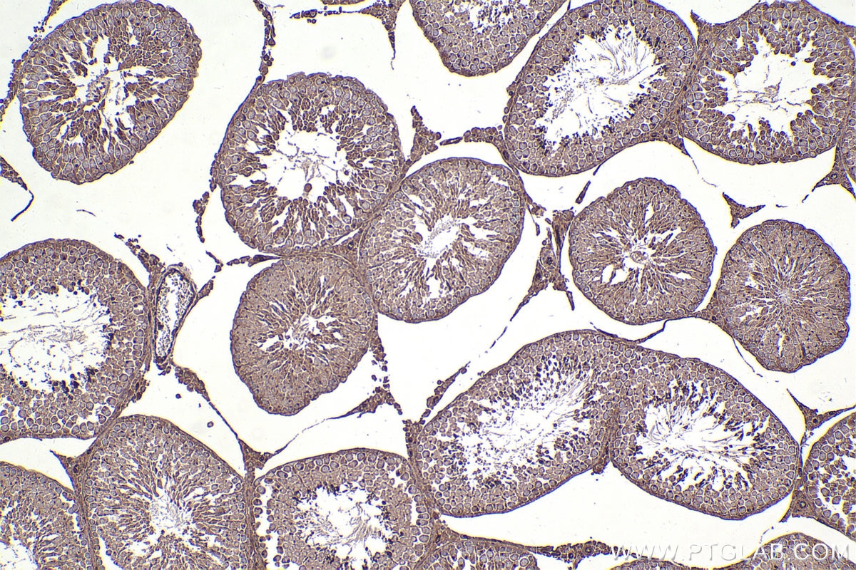 Immunohistochemical analysis of paraffin-embedded rat testis tissue slide using KHC2377 (XIAP IHC Kit).